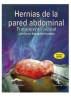 Hernias de la pared abdominal