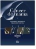 Cáncer de mama