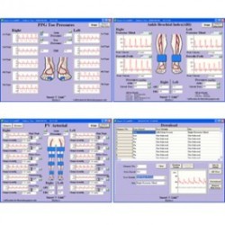 Software V-Link O Fetal Link para PC Windows para mini doppler